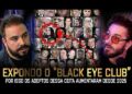 🚨 PQ MUITAS CELEBRIDADES estão APARECENDO com o “OLHO ROXO” ? -THIAGO LIMA e VILELA (BLACK EYE CLUB)