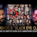 🚨 PQ MUITAS CELEBRIDADES estão APARECENDO com o “OLHO ROXO” ? -THIAGO LIMA e VILELA (BLACK EYE CLUB)