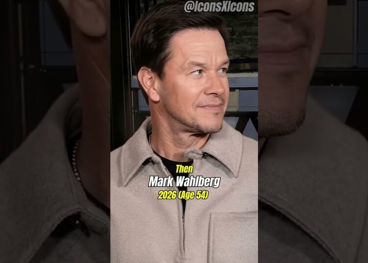 Celebridades antes e depois impressionante