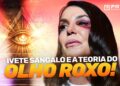 Teorias de que famosos aparecem com olhos roxos!