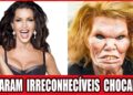 10 Celebridades De Hollywood Que Arruinaram O Rosto Com Cirurgia Plástica | Antes E Depois 2026