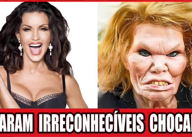 10 Celebridades De Hollywood Que Arruinaram O Rosto Com Cirurgia Plástica | Antes E Depois 2026