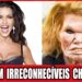 10 Celebridades De Hollywood Que Arruinaram O Rosto Com Cirurgia Plástica | Antes E Depois 2026