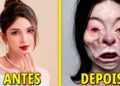 DESASTRES EM CIRURGIAS PLÁSTICAS DE FAMOSOS