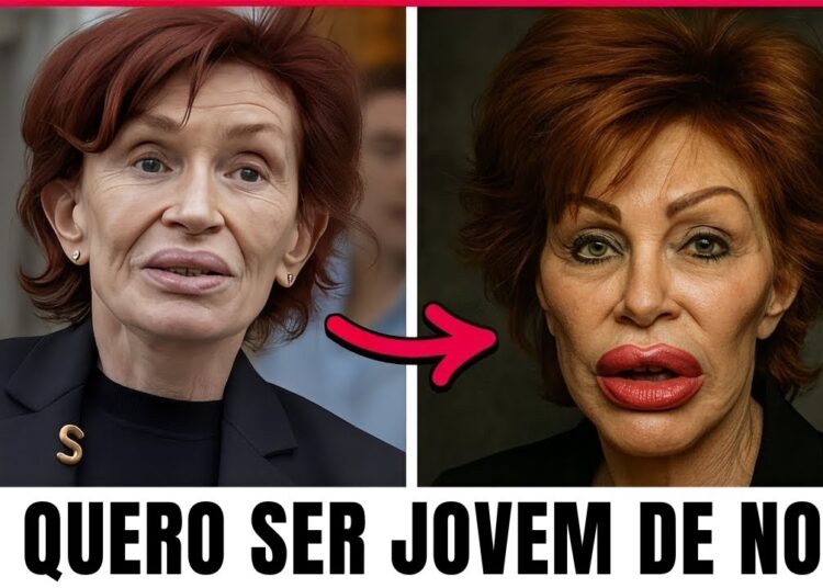 15 celebridades que destruíram completamente o rosto com cirurgias plásticas