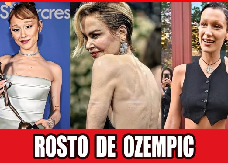20 Impactantes Transformações de Celebridades com OZEMPIC em 2026
