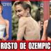 20 Impactantes Transformações de Celebridades com OZEMPIC em 2026