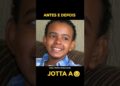 ANTES E DEPOIS DE JOTTA A #famosos #cantor #jottaa #reels #song #cover #music #singer #lyrics #love