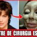 FAMOSAS Irreconhecíveis Após CIRURGIAS PLÁSTICAS Que Deram Errado!