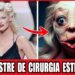 13 Desastres De Cirurgia Plástica Que Destruíram A Carreira Das Estrelas De Hollywood!
