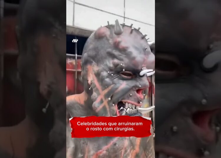 Celebridades que arruinaram o rosto com cirurgias.