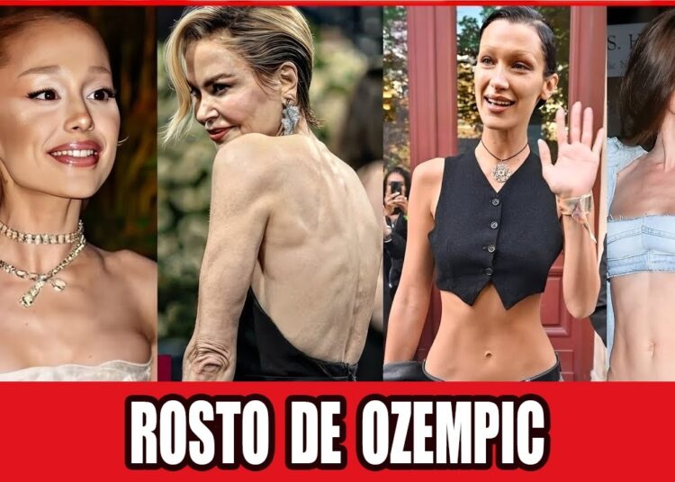 Celebridades Com O Rosto Ozempic: Transformações Chocantes Antes E Depois 2026!