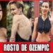 Celebridades Com O Rosto Ozempic: Transformações Chocantes Antes E Depois 2026!