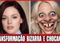 10+ Celebridades Que ARRUINARAM Seus Rostos Com Cirurgia Plástica (Parte 2) | Antes e Depois 2026