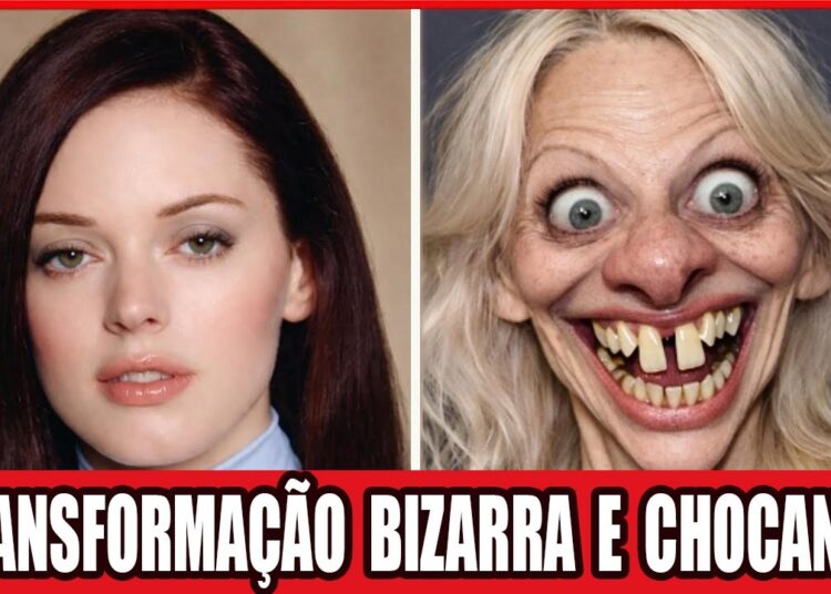 10+ Celebridades Que ARRUINARAM Seus Rostos Com Cirurgia Plástica (Parte 2) | Antes e Depois 2026