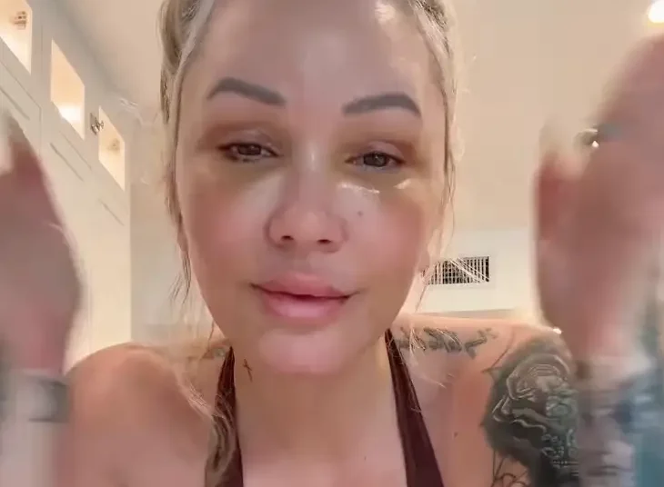A esposa de Jelly Roll, Bunnie Xo, compartilha o inesperado efeito colateral de 'sufocação' do recente facelift