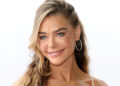 Denise Richards deixa cair o queixo em fotos de antes e depois do facelift