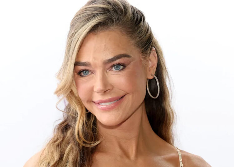 Denise Richards deixa cair o queixo em fotos de antes e depois do facelift