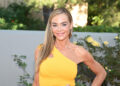 Denise Richards discute sua jornada de lifting facial e compartilha fotos de antes e depois