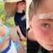 Hilaria Baldwin revela que filho Leo, 9, abriu a testa durante férias em família na praia