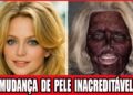 18 Celebridades Que COMPLETAMENTE Arruinaram Seus Rostos Com Cirurgia Plástica | Antes e Depois 2026