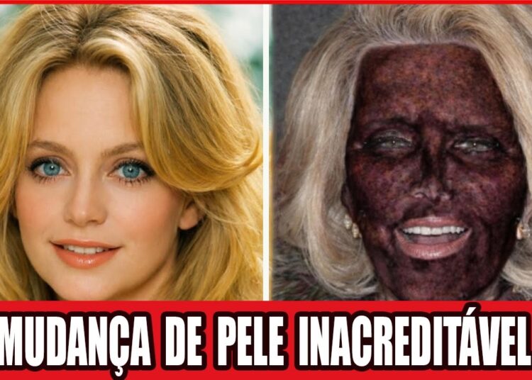 18 Celebridades Que COMPLETAMENTE Arruinaram Seus Rostos Com Cirurgia Plástica | Antes e Depois 2026