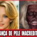 18 Celebridades Que COMPLETAMENTE Arruinaram Seus Rostos Com Cirurgia Plástica | Antes e Depois 2026