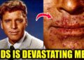 Hollywood Stars Suffer From Extremely Rare and Incurable Disease