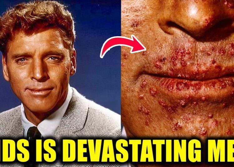 Hollywood Stars Suffer From Extremely Rare and Incurable Disease