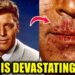 Hollywood Stars Suffer From Extremely Rare and Incurable Disease