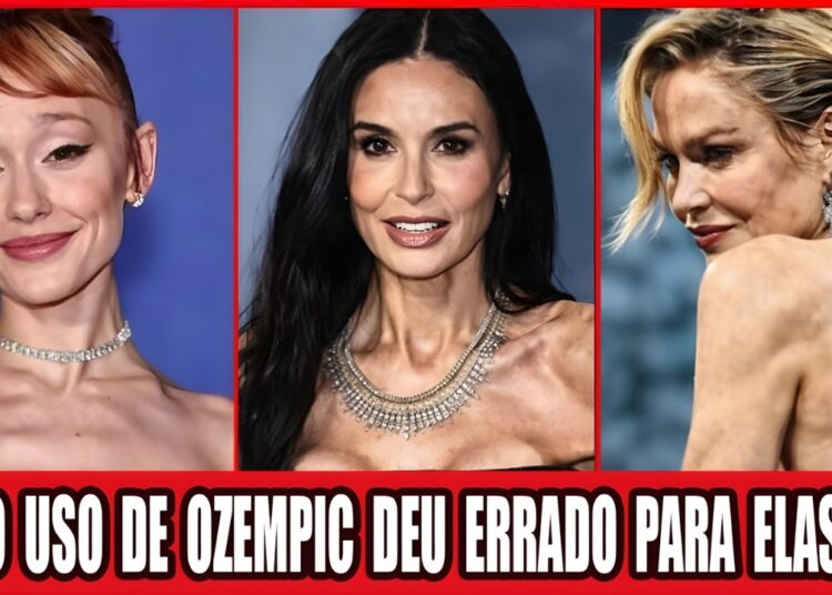 10 Transformações Chocantes OZEMPIC Em Celebridades Que Deram Errado | Antes E Depois 2026