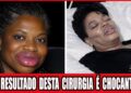 Top 10 Celebridades Negras Com Finais Trágicos Após Cirurgia Estética!