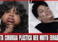Top 14 Celebridades Negras Com Finais Chocantes Após Cirurgia Estética