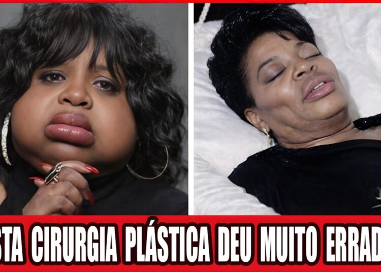 Top 14 Celebridades Negras Com Finais Chocantes Após Cirurgia Estética