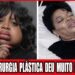 Top 14 Celebridades Negras Com Finais Chocantes Após Cirurgia Estética