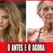 10 Celebridades Que Não Vai Acreditar Que Morreram De Anorexia (Atualização Comovente)