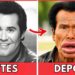 7 Desastres de Cirurgia Plástica de Celebridades