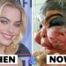 35 Stars Transformed by Plastic Surgery Disasters | Then and Now Photos 2026