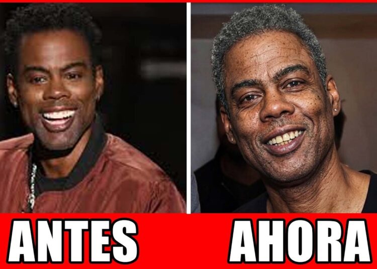 11 Celebridades Negras Que Envelheceram Mal | Antes E Depois 2026