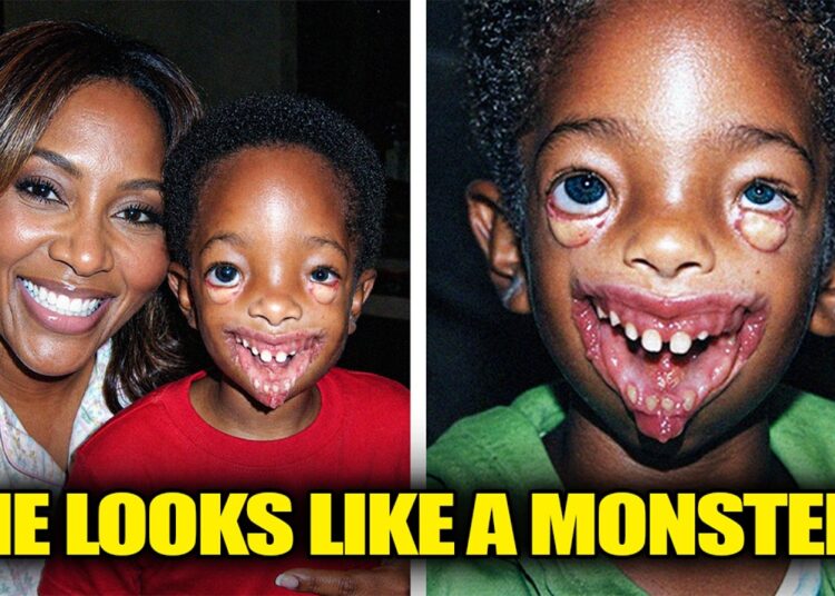 15 Black Celebrities Who Have Children With Disabilities