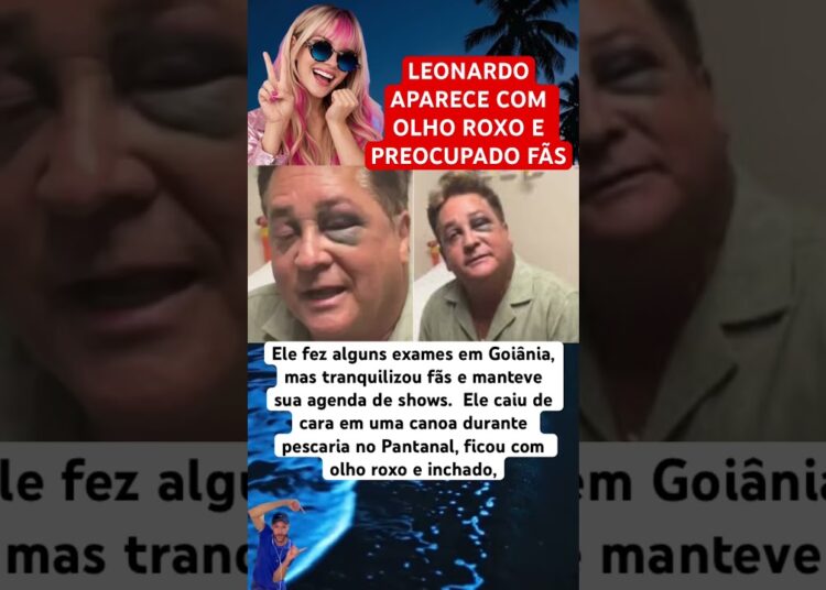 LEONARDO APARECE COM OLHO ROXO E PREOCUPA DEUS FÃS #feedshorts #ultimasnoticia #fofoca