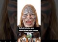 😱 CHOCANTE Celebridades que DESTRUÍRAM seus rostos Você NÃO vai acreditar no antes e depois #shorts