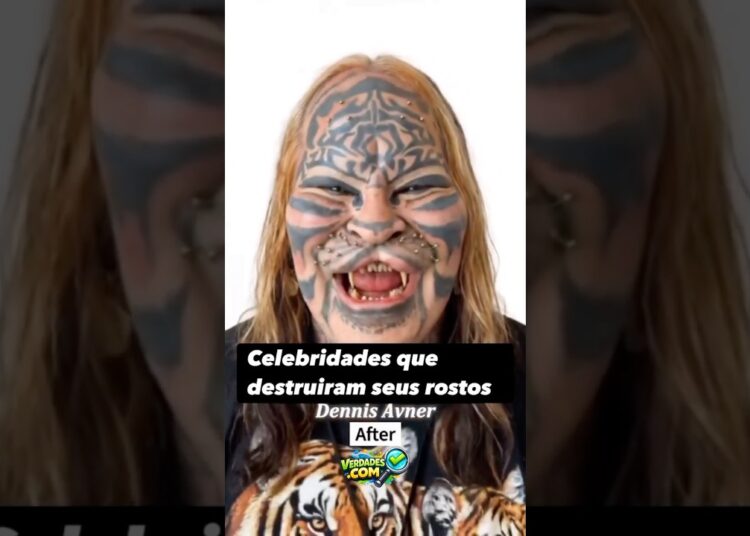 😱 CHOCANTE Celebridades que DESTRUÍRAM seus rostos Você NÃO vai acreditar no antes e depois #shorts