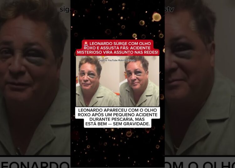 🚨 Leonardo SURGE COM OLHO ROXO E ASSUSTA FÃS: ACIDENTE DURANTE PESCARIA VIRA MISTÉRIO NAS REDES!