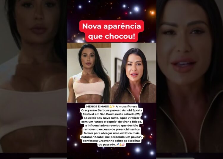 Rosto novo! Gracyanne Barbosa revela por que removeu preenchimentos. 💉😱 #fofoca
