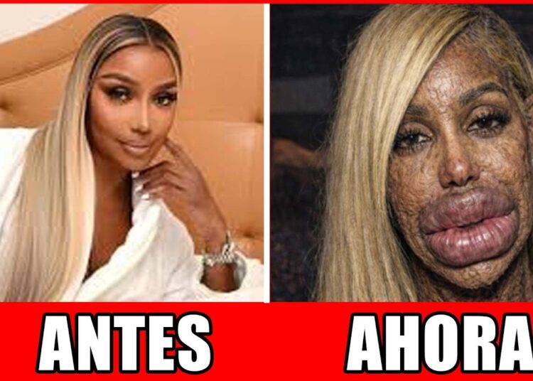 11 Celebridades Negras Cujos Rostos E Carreiras Mudaram Após Cirurgia Plástica | Antes E Depois 2026