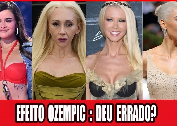 Ozempic Que Deu Errado — Transformações Chocantes De Celebridades Que Falharam!