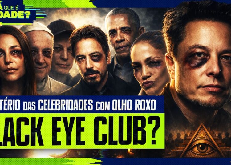O MISTÉRIO DAS CELEBRIDADES COM OLHO ROXO: BLACK EYE CLUB – Será Que É Verdade? #005