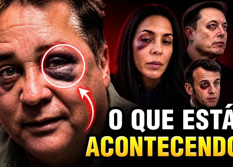 MAIS FAMOSOS ESTÃO COM OLHO ROXO… Seria um Pacto?