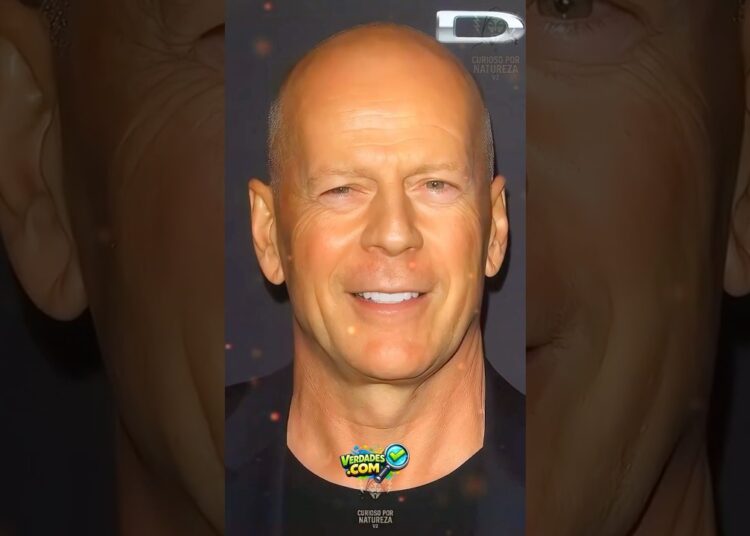 😱 Celebridades que Mudaram PARA SEMPRE… Você Não Vai Acreditar no Antes e Depois! #shorts
